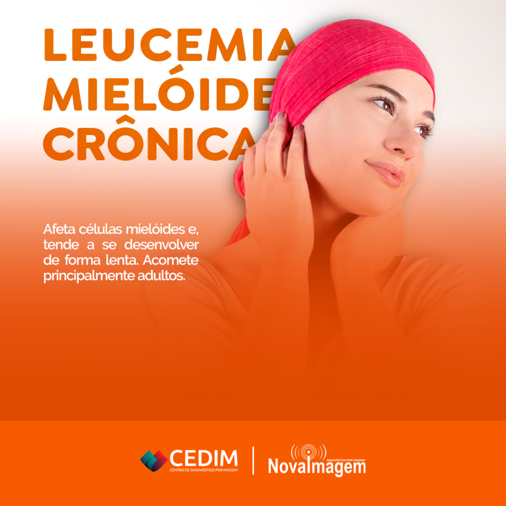 Leucemia Mielóide Crônica