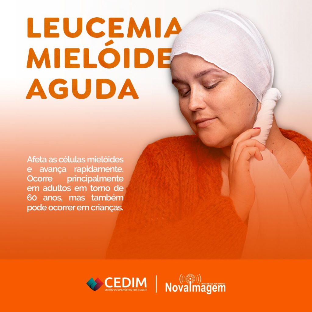 Leucemia Mielóide Aguda