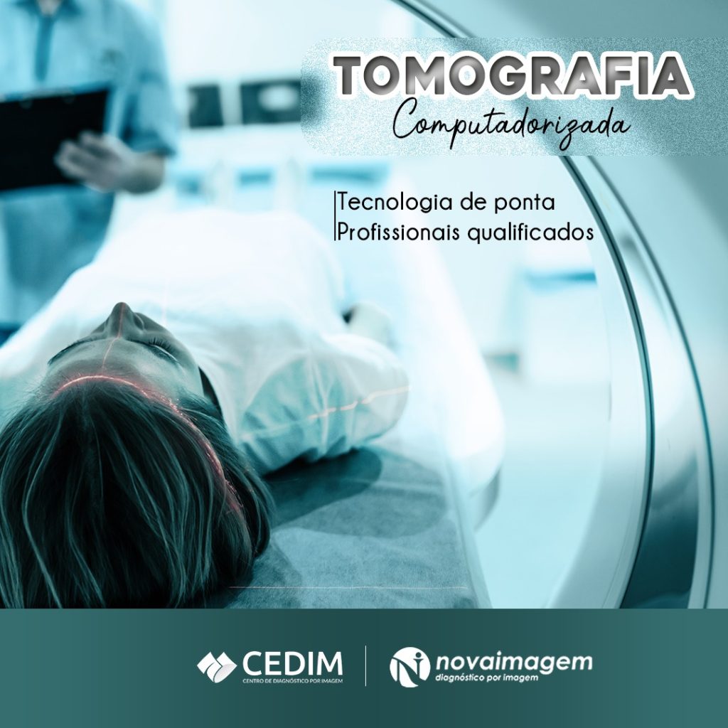 Página Cedimagem Diagnósticos - Tomografia do Maxilar e